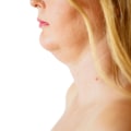 The Truth About Nonsurgical Fat Reduction And Double Chin Liposuction In NYC