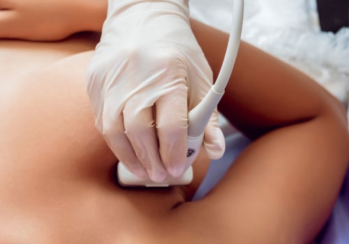 How Medical Spa In Jacksonville, FL Is Leading The Way In Nonsurgical Fat Reduction Treatments